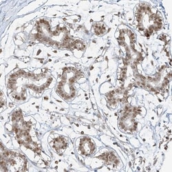 ZNF198 Antibody, Novus Biologicals:Antibodies:Primary Antibodies